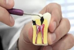 Eu vou te enviar resumos de endodontia