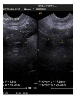 Eu vou Ouvir e dar conselhos