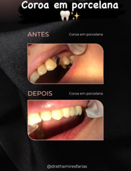 Eu vou avaliar e dar feedback