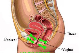 Eu vou te ajudar com seu vaginismo